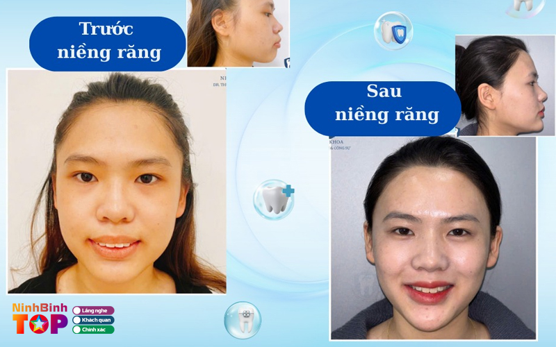 Nha-khoa-dr-thuan-ninhbinhtoplist