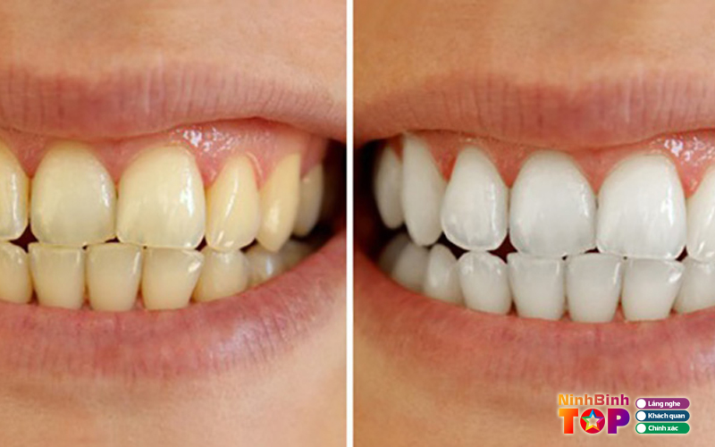 Nha-khoa-thu-do-ninhbinhtoplist