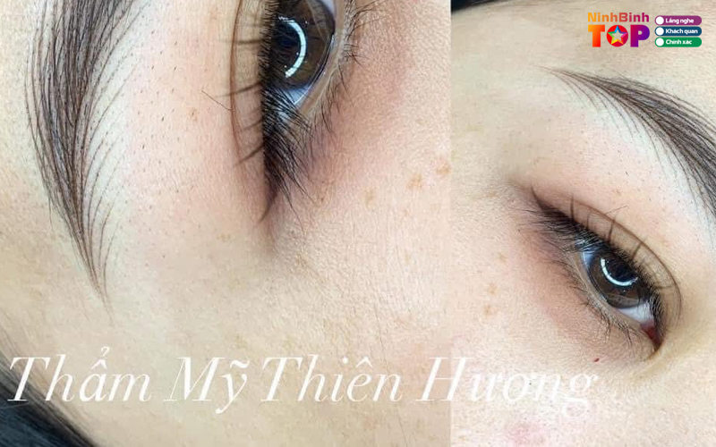 Tham-my-thien-huong-ninhbinhtoplist