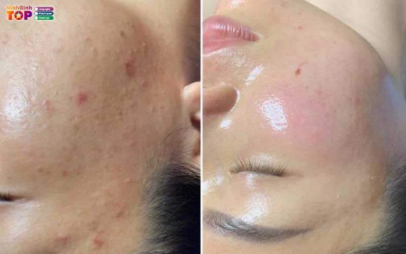 Moc-mien-spa-ninhbinhtoplist