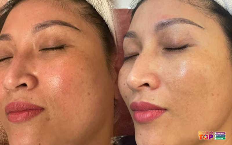 Tham-my-hoang-hong-ninhbinhtoplist