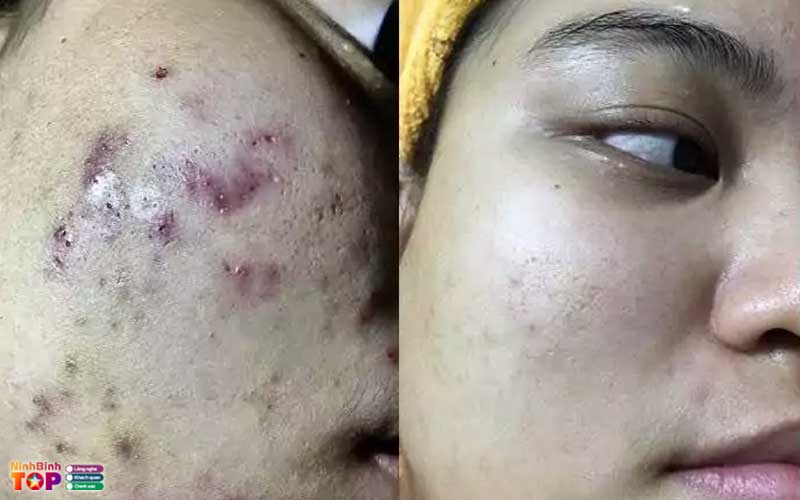 Thang-long-beauty-clinic-ninhbinhtoplist