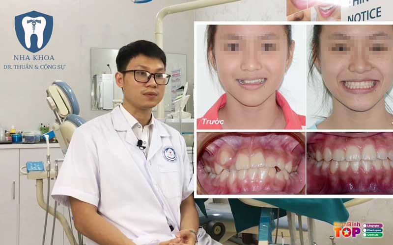 Nha-khoa-dr-thuan-cong-su-ninhbinhtoplist