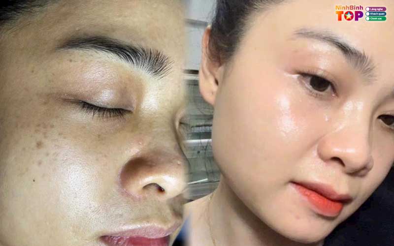 Min-soo-beauty-spa-ninhbinhtoplist