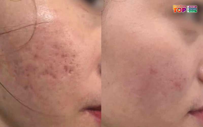 Min-soo-beauty-spa-ninhbinhtoplist